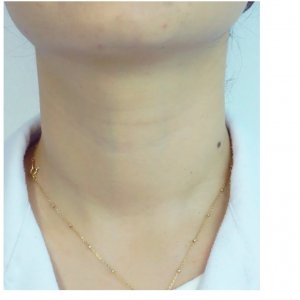 Crema pentru gat si linii fine Advanced, 40g, Dermafirm