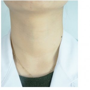Crema pentru gat si linii fine Advanced, 40g, Dermafirm