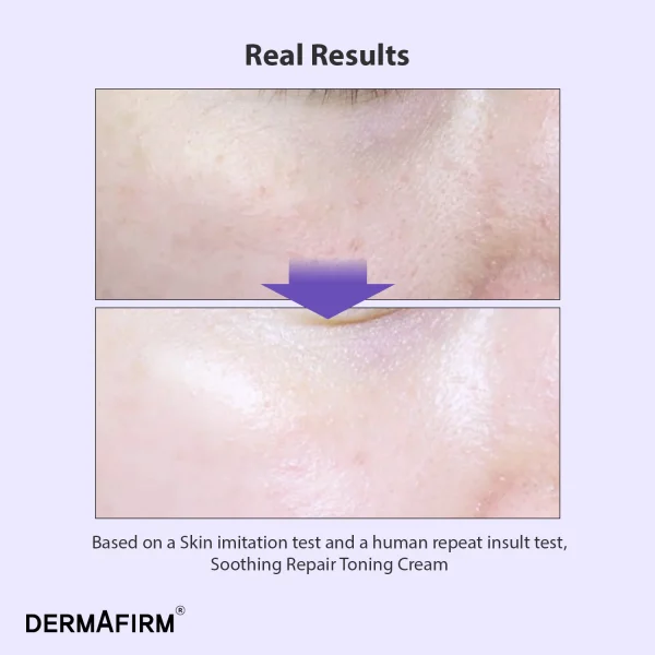 Cremă tonifiantă cu Glutathione Nano Brightening™ Repair Toning Cream R4, 50ml, Dermafirm