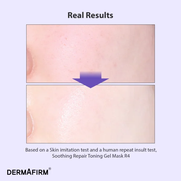 Mască cu Glutathione, niacinamide și Re-peptide, Soothing Repair Toning Gel Mask R4, 1buc, Dermafirm