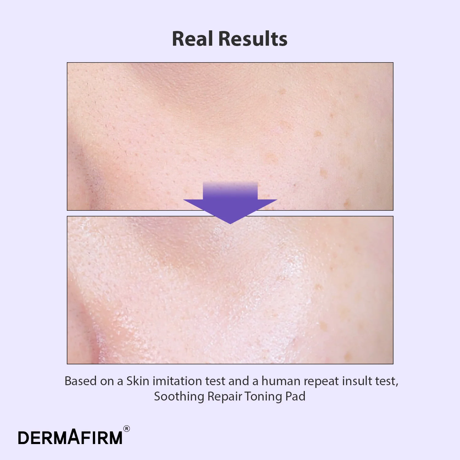 Dischete exfoliante îmbibate cu Glutation si PHA/AHA/LHA, Soothing Repair Toning Pad R4, 180ml/70buc, Dermafirm