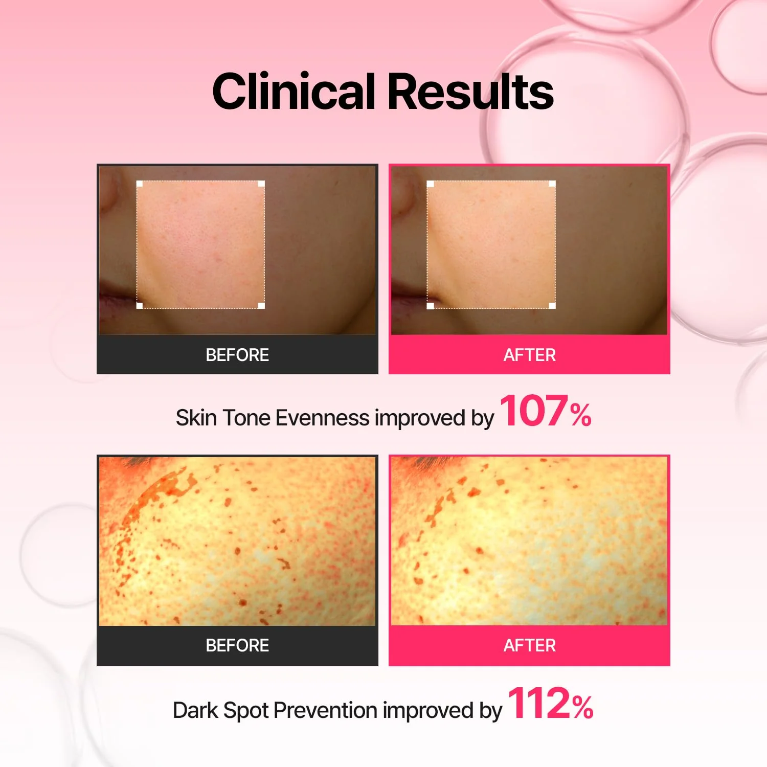 Serum Arbutin Skin Booster + Dispozitiv cu microcurent, 150ml, Meditherapy