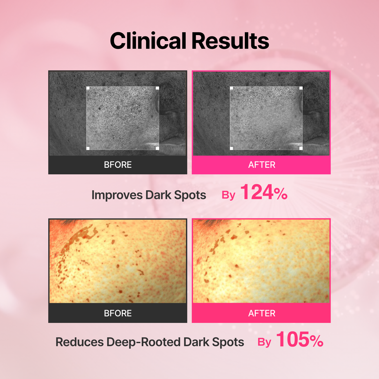 Crema Tranexamic Acid Skin Booster + Dispozitiv cu microcurent, 100ml, Meditherapy