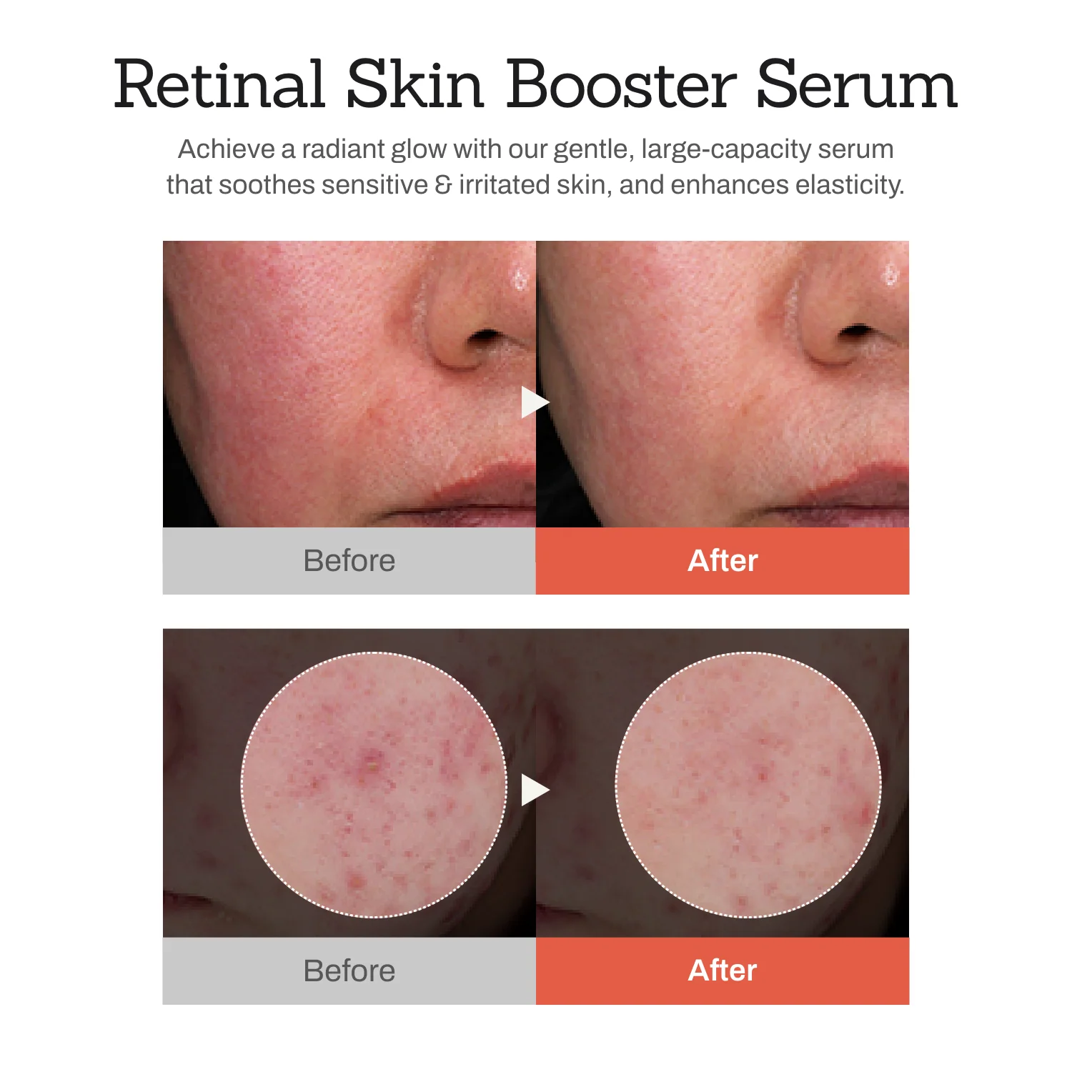 Serum Retinal Skin Booster, 150ml, Meditherapy